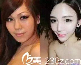 整容网红爆料视频大全下载,视频大全深度解析  第2张